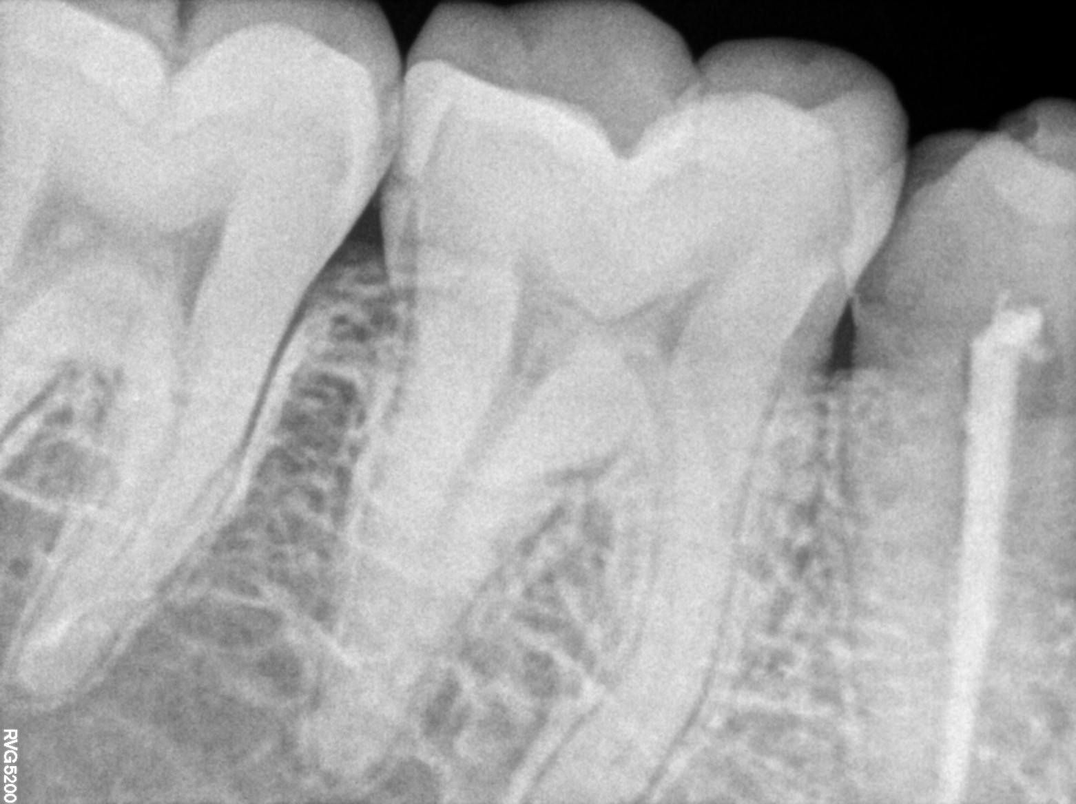 Dental X-ray